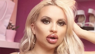 Barbie Olmak İçin 250 bin TL Harcadı! Şimdi İse Yeni Hali Eski Halini Aratıyor..