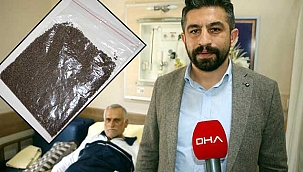 Safra kesesinden binlerce taş çıktı.Guinness'e başvurdu