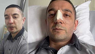 Bakırköy'de darbedilen güvenlik görevlisi...