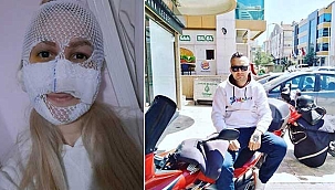 Yüzüne kimyasal madde atılan Sultan: Belki beni bu son görüşünüz