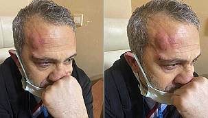 Flaş Haber...Hasta yakınları hemşireyi darbetti