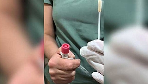 Hacettepe Üniversitesi'nden rahim ağzı kanseri için test kiti