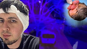 Sokak köpeklerinin saldırısına uğrayan Nazif...