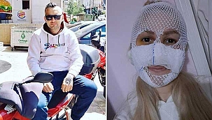 Sultan'ın yüzüne kimyasal madde atan firari eski sevgilisi...