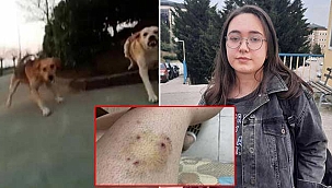 Üniversitesi öğrencisi kampüste köpek saldırısına uğradı