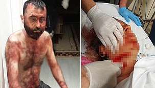 Akılalmaz olayda eski koca maket bıçağı ile dehşet saçtı!