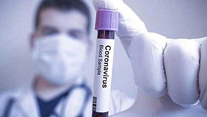 Beklenen haber geldi! Günlük vaka sayısı 905 oldu