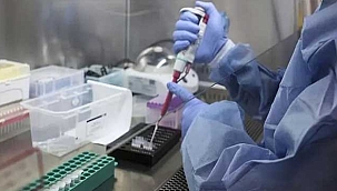 Maymun çiçeği virüsü hangi ülkelerde görüldü? Kaç kişiye bulaştı? Belirtileri nelerdir?