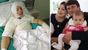 Eski eşinin yaktığı Elvan...