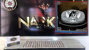 İranlı yolcu, 1 kilo afyon sakızı yutmuş