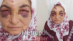 Kayseri'de otobüs şöförünün dikkatsizliği canından ediyordu