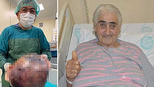 Nefes darlığı şikayetiyle gitti! Karnından 10 kiloluk tümör çıkarıldı! 