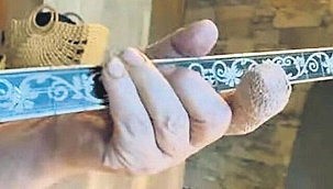  Orhan Gencebay'ın Parmağı Kopuyordu 