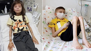 Bursa'da 'Çöp ev'de bulunan Cem Muhammet, taburcu edildi