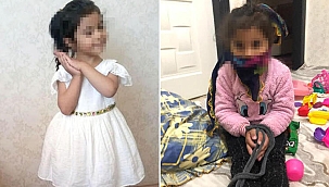 Gaziantep'te Pitbull saldırısında yaralanan Asiye'nin 'elleri bağlı' görüntüleri tepki çekti