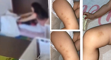 2 yaşındaki çocuğa kreşte darp; 2 görevli suçlamayı kabul etmedi