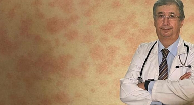 Prof. Dr. Çokuğraş: Yıllardır görmediğimiz kızamık vakaları yeniden ortaya çıktı