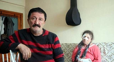 54 yaşındaki kadın akrabaları tarafından baltalı saldırıya uğradı