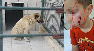 Bursa'da sokak köpeğinin saldırısına uğrayan çocuk yüzünden yaralandı