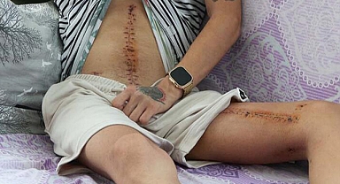 Alkollü sürücü dehşeti! 14 el ateş etti