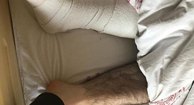 Flaş İddia:Yanlış Bacağından Ameliyat Edildi...