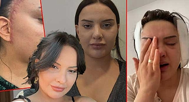  İzmir'de 30 yaşındaki kadın estetik olduğuna pişman oldu