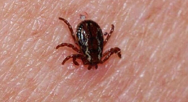 Tarlada vücuduna yapışan keneyi cımbızla çıkartan Hilal..