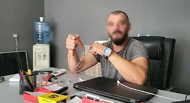 9 Defa Yüzüne Kafa Atılan Kızın Burnu Kırıldı