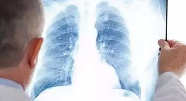 Prof. Dr. Özlü'den zatürre ile ilgili çok önemli açıklamalar