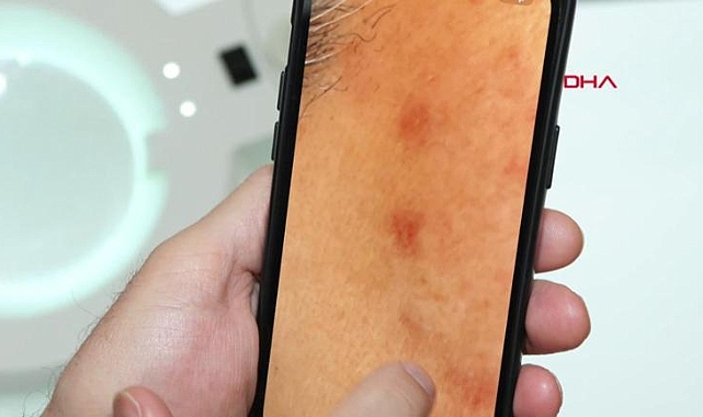 'Aşırı makyaj ve kozmetik yüzünden cilt bariyeri 18'li yaşlarda çöküyor’
