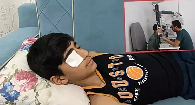 Göz kapağına yapıştırıcı sıçradı doktor müdahalesiyle açıldı 