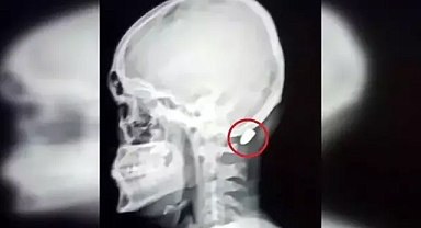 'Silah sesi duyduğunuzda gizlenin'