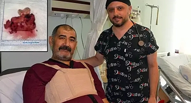 Nadir görülen operasyon kalbinde 10 santimlik kitle tespit edildi ve alındı 