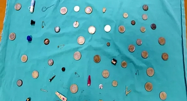 Tıbbın garip arşivi profesörün belleğindeki yutulan nesneler