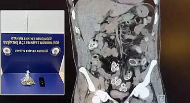 Fas'tan Beşiktaş'a hava yolu ile midesinde 49 adet esrar macunu getirdi