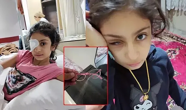 Gözlük camı gözüne battı, sağ gözünü kaybetti.