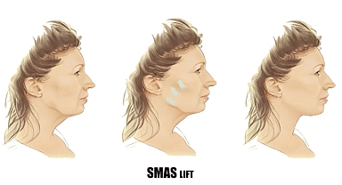 Prof. Dr. Ahmet Karacalar: 