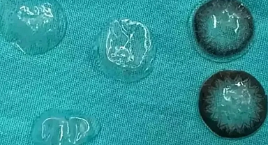 5 Kontak Lensle Yaşamış