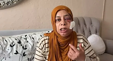 Akraba ziyaretine giden kadın ölümden döndü