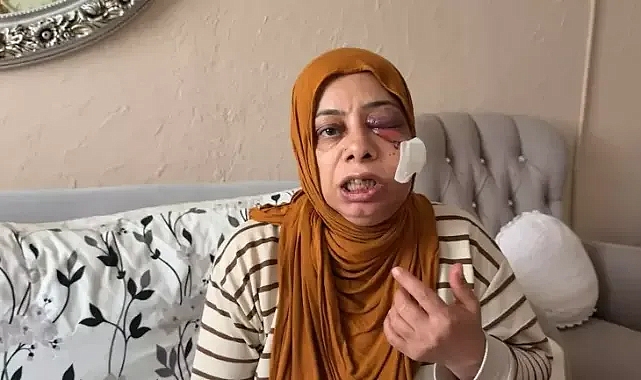 Akraba ziyaretine giden kadın ölümden döndü