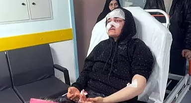 Boşandığı eşini kaldırım taşı ile darp etti; genç kadın, hapisten çıkmasın diye feryat etti