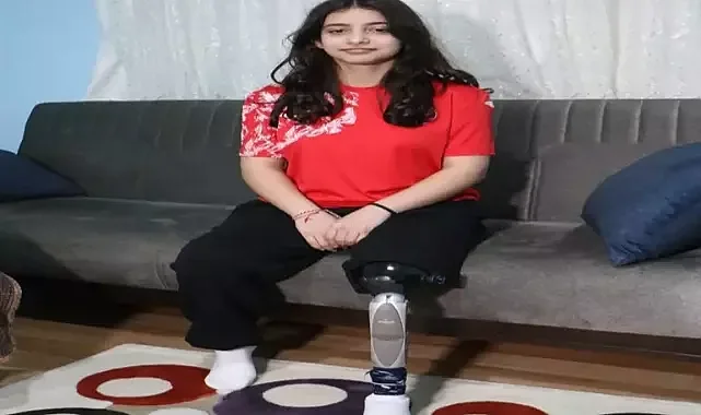 Enkazdan 45 saat sonra kurtarılan ve tek bacağını kaybeden genç kız estetik cerrah olmak istiyor