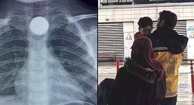 Evde bulduğu 50 kuruş yemek borusuna kaçan minik Bilal'in tedavisi devam ediyor