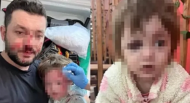 Ne Bakıyorsun? Tartışması Kanlı Bitti: Bebek Yaralandı