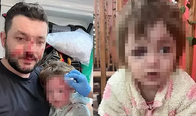 Ne Bakıyorsun? Tartışması Kanlı Bitti: Bebek Yaralandı