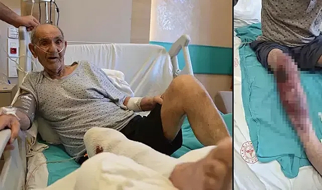 Lavabo açıcı bacağını yaktı