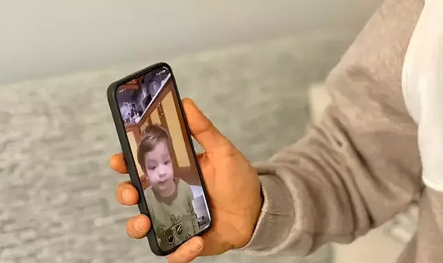 Pitbull saldırısında yaralanan kardeşlerin babası: Oğlumun yüzündeki yara kalıcı olacak gibi