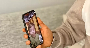 Pitbull saldırısında yaralanan kardeşlerin babası: Oğlumun yüzündeki yara kalıcı olacak gibi