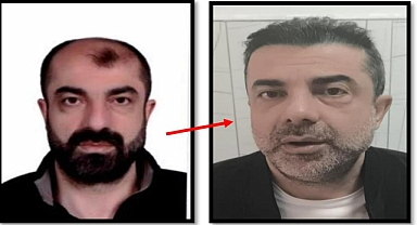 Estetikle Kimliğini Gizleyen Cinayet Zanlısı Yakalandı