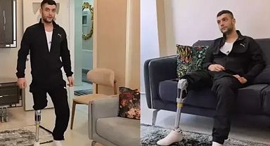 Kazada bacağını kaybetmişti: Hayırseverler Akın'ı yeniden yürüttü